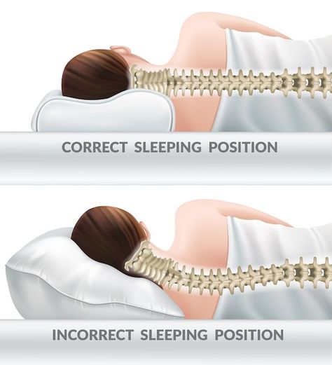 Free vector correct and incorrect sleepi... | Free Vector #Freepik #freevector #posture #ergonomics #neck-pain #neck Healthy Sleeping Positions, Forward Head Posture Exercises, Sleeping Pose, Neck And Shoulder Muscles, Forward Head Posture, Knee Pillow, Posture Exercises, Orthopedic Pillow, Upper Back Pain