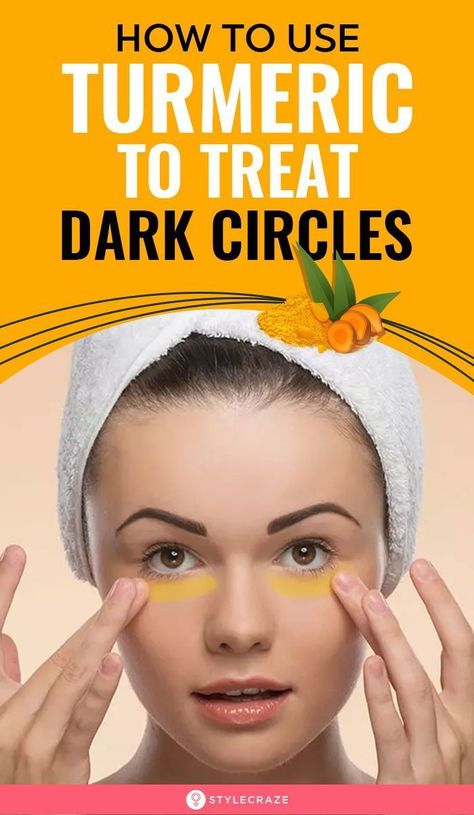 Turmeric Paste, Dark Circle Remedies, Dark Circles Around Eyes, Beauty Myth, Dark Eye Circles, Brown Spots Removal, Remove Dark Circles, Skin Care Wrinkles, Dark Circles Under Eyes