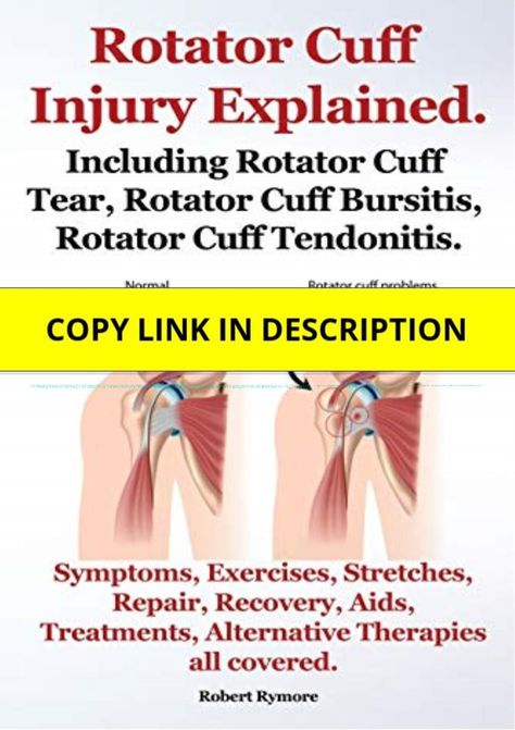 (PDF) Rotator Cuff Injury Explained. Including Rotator Cuff Tear, Rotator Cuff Bursitis, Rotator Cuff Tendonitis. Symptoms, Exercises, Stretches, Repair, Re Paperback â€“ October 20, 2013 Kindle Rotator Cuff Surgery, Rotator Cuff Tear, Shoulder Impingement, Rotator Cuff Injury, Shoulder Surgery, Frozen Shoulder, Orthopedic Surgery, Knee Surgery, Rotator Cuff