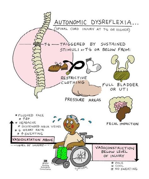 dysreflexia | SUPAHNARS: AUTONOMIC DYSREFLEXIA Neurogenic Shock, Autonomic Dysreflexia, Nclex Tips, Spinal Cord Injuries, Nurse Job, Study Sheets, Nurse Study, Medical Study, Nursing Information