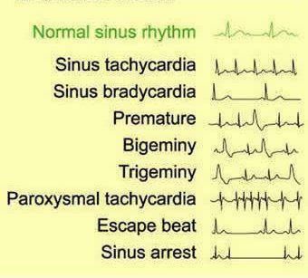 Certified Medical Assistant, Learning Logo, Cardiac Nursing, Respiratory Therapy, Nursing School Tips, Nursing Tips, Future Nurse, Nursing Study, Nursing Notes