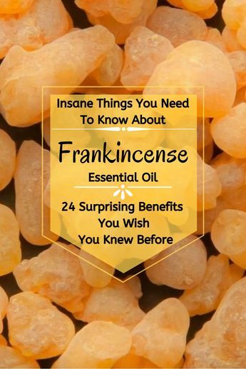 Frankinsence Essential Oil Benefits, Frankincense Blends, Frankensence Oil Uses, Benefits Of Frankincense Essential Oil, Make Your Own Essential Oils, Benefits Of Frankincense, Frankincense Uses, Frankincense Essential Oil Benefits, Essential Oil Frankincense