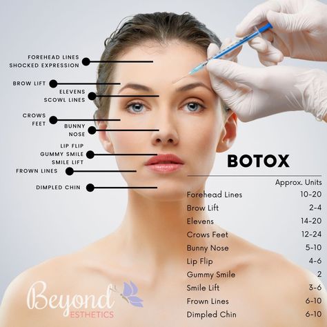 Botox Smile Lines Before After, Where To Get Botox On Face, Botox Injection Sites, Facial Injections, Lip Flip, Botox Before And After, Botox Lips, Facial Anatomy, Botox Cosmetic