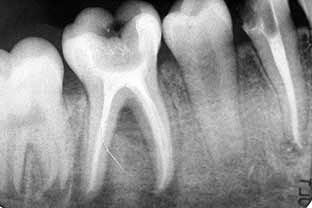 Teeth Xray, Nutrition Bulletin Boards, Nutrition Poster, Human Mouth, Strawberry Nutrition Facts, Nutrition Chart, Nutrition Club, Nutrition Quotes, Nutrition Month