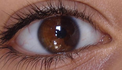 Sectoral heterochromia brown eyes Heterochromia Eyes Aesthetic, Brown Heterochromia Eyes, Brown And Green Heterochromia, Green Brown Heterochromia, Sectoral Heterochromia Brown, Different Color Eyes Heterochromia, Sectoral Heterochromia, Central Heterochromia, Heterochromia Eyes