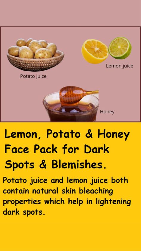 Skin Lightening Diy, Potato Face, Potato Juice, Diy Beauty Treatments, Natural Skin Care Remedies, Honey Face, Diy Skin Care Recipes, Dark Spots On Skin, Face Pack