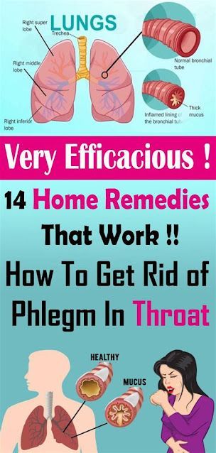 How To Get Rid of Phlegm In Throat: 14 Home Remedies That Work Phlegm In Throat, Get Rid Of Mucus, Yellow Mucus, Getting Rid Of Mucus, Medicine Images, Getting Rid Of Phlegm, Health Articles Wellness, Health Tips For Women, A Bug