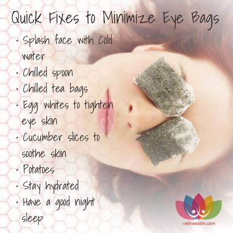 Quick Fixes to Minimize Eye Bags. |  #Beauty | #Eyes | #EyeBags | be#NaturalRemedy Reduce Eye Bags, Dry Eyes Causes, Under Eye Makeup, Eyes Problems, Skin Care Remedies, Dry Eyes, Eye Serum, Puffy Eyes, Eye Bags