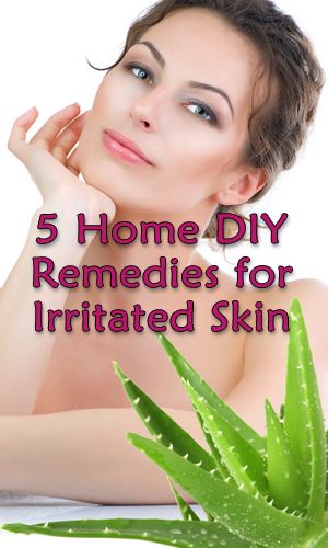 5 Home DIY Remedies for Irritated Skin Irritated Skin Remedies, Skin Tags Apple Cider Vinegar, Relaxation Ideas, Remove Skin Tags Naturally, Skin Care Home Remedies, Homemade Spa, Korean Beauty Secrets, Clothing Tips, Diy Remedies