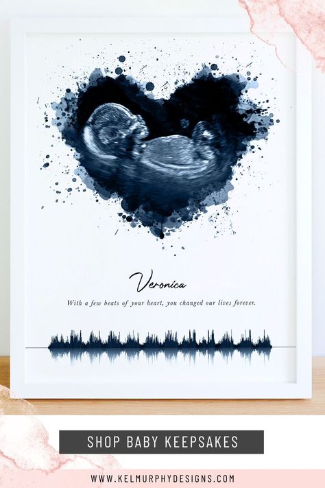 Preserve this precious moment with a watercolor ultrasound or embryo design. This piece can be personalized with your custom wording such as baby's name, birth stats and/or special quote. This is a wonderful gift idea for new parents, a couple who has experienced fertility issues, to memorialize an angel baby, a surrogate present, or for your pregnancy announcement. #ultrasoundart #embryoart #babykeepsake #babyshowergift #newmomgift Birth Memory Ideas, Sonogram Keepsake Ideas, Angel Baby Memorial Ideas, Hand Casting Ideas Family Of 3, Ultrasound Keepsake Ideas, Ultra Sound Picture Ideas, Custom Gift Ideas For Him, Baby Memories Ideas, Pregnancy Memory Ideas