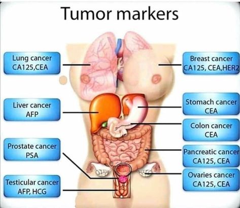 Hematology Nursing, Pharmacy School Study, Medical Terminology Study, Nursing School Essential, Nurse Study Notes, Nursing Mnemonics, Medical Student Study, Medical Laboratory Science, Oncology Nursing