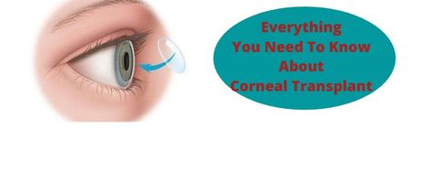 Cornea Eye, Lasik Eye Surgery Aesthetic, Corneal Transplant, Eyebrow Transplant, Lasik Eye Surgery, Organ Transplant, Eye Infections, Dust Particles, Eye Spy