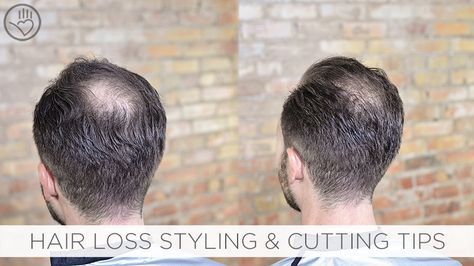 Discover how to create the illusion of thicker looking hair for thinning or balding clients along with creating balance between dense and light hair. Haircuts For Balding Men, Balding Mens Hairstyles, Receding Hair Styles, Male Pattern Baldness, Pattern Baldness, Bald Hair, Bald Men, Lost Hair, Thinning Hair