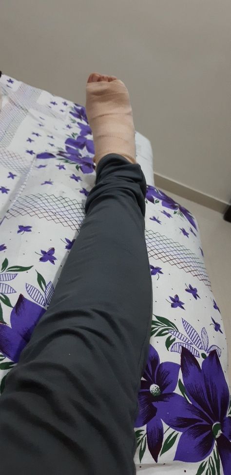 Leg Injury Insta Story, Back Injury Snapchat, Football Injury Snapchat, Fractured Leg Snap, Hospital Leg Injury, Leg Photo Snapchat, Hand Plaster Fracture Snap, Leg Accident Real Pic In Hospital, Hand Fracture Fake Story