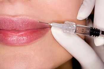 Botox Injection Sites, Botox Cost, Botox Alternative, Subcutaneous Tissue, White Lips, Two Lips, Lip Augmentation, Injectables Fillers, Lip Filler