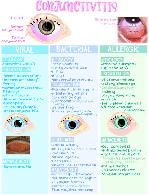 Optometry School Notes, Opthalmic Technician Aesthetic, Optometry Notes, Ophthalmology Notes, Optical Technician, Medical Study Notes, Opthalmic Technician, Ophthalmic Technician, Optician Training