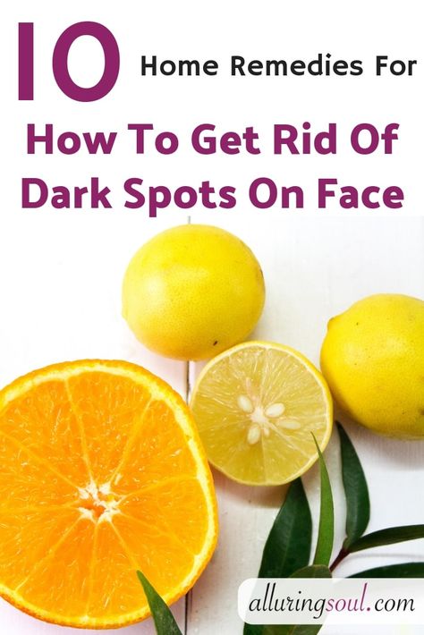 How To Remove Dark Spots On Face – 10 Home Remedies Frankincense Anti Aging, Black Spots On Face, Face Form, Brown Spots On Skin, Aloe Vera Face Mask, Dark Spots On Face, Brown Spots Removal, Brown Spots On Face, Dark Spot Corrector