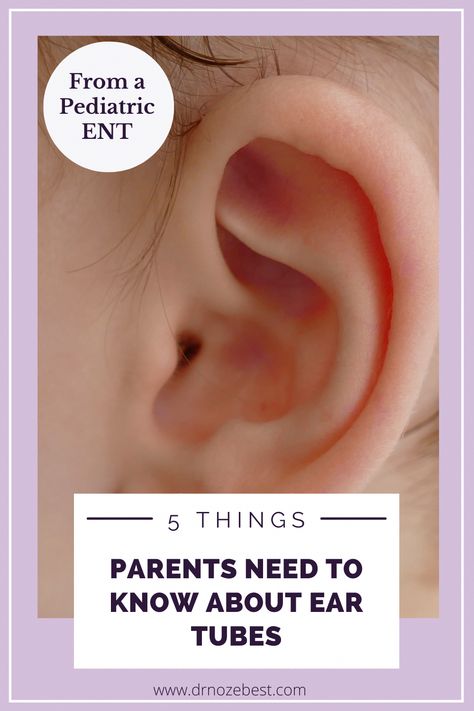 One of the worst things you can experience as a parent is seeing your child in any pain. If your child has multiple ear infections in a short period of time, your doctor may recommend them getting ear tubes. Dr. Steven Goudy highlighted 5 things that parents should know about ear tubes. Ear Aches Remedies For Kids, Ear Tubes, Ear Ache, Reflux Diet, Middle Ear, Ear Infections, Lip Care Routine, Ear Health, Gi Tract