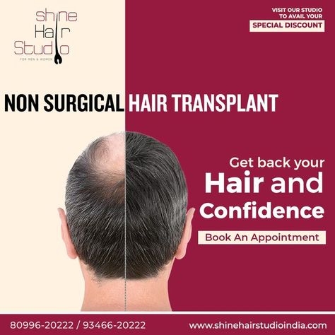 #hairpatches #hairpatchesrajahmundry #rajahmundry #Rajamahendravaram #hairwigsRajamahendravaram #hairextensionsRajamahendravaram #wigsinrajahmundry #hairservicesrajahmundry #hairfixingrajahmundry #hairpatchesinrajahmundry #hairreplacementrajahmundry #hairwigservicesrajahmundry #hairtoupeesrajahmundry #hairreplacementnonsurgicalrajahmundry #nonsurgicalhairreplacement #baldnesstreatmentrajahmundry
#humanhairrajahmundry #hairpatchservicesrajahmundry
#hairrajahmundry #haircarerajahmundry #wigs Thread Lift Face, Confidence Books, Laser Hair Reduction, Vampire Facial, Hair Fixing, Front Hair, Hair Clinic, Types Of Hair, Hair Extensions Best