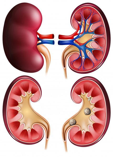 Kidney Specialist, Human Brain Diagram, Kidney Anatomy, Brain Diagram, Human Kidney, Healthy Kidneys, Kidney Health, Homeopathy, Agra