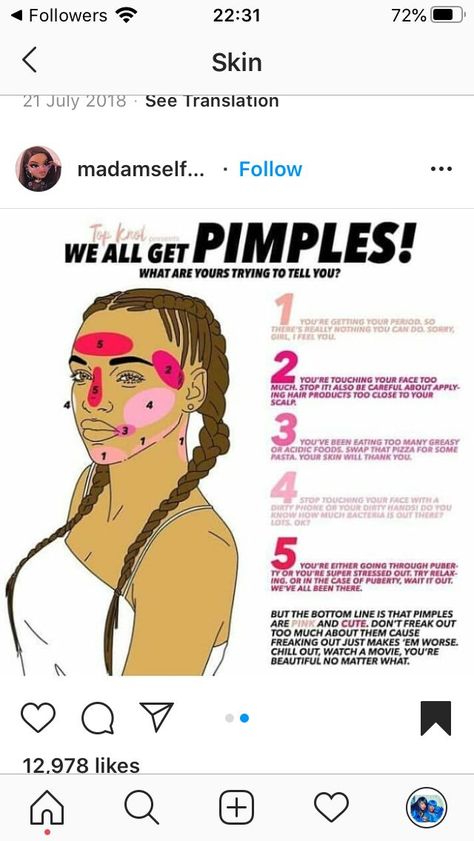 Please Re-Pin for later 😍💞 Revitalize Your Skin - Click Here! 💯 pimples in pubic area, pimples in nose lupus, eczema on face steroid cream 👍 #selfcare #toner #dryskin What Pimples In Different Places Means, What Ur Pimples Mean, How To Get Rod Of Pimples Fast At Home, Where Your Pimples Are And What It Means, Pimple Area Meaning, Pimple Chart, Pimple Meaning, Bumps On Face, What Causes Pimples