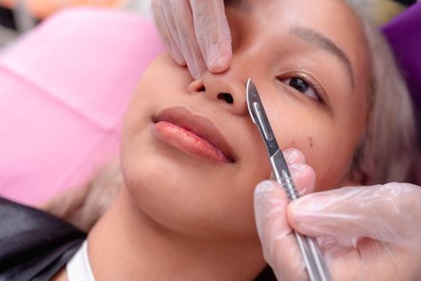 Dermaplaning is Trending, But Is It For Everyone? 🤔 

However, this is a professional service, and getting it done at a dermatologist’s office will yield different results than an at-home attempt. Like getting a mani and pedi at your nail salon, an at-home job will not be the same or look the same. 

So, is dermaplaning for everyone? It is important to understand more about what dermaplaning is, what it is meant to provide, and who the most eligible candidates are. Dermaplane At Home, Dermaplaning At Home, Dermatology Office, Mani And Pedi, Social Media Apps, Skin Care Treatments, New Skin, Dermatology, How To Apply Makeup