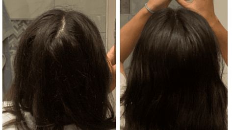 How To Easily Get Rid Of Back Hair Part [Tips + Prevention] - Hello Mia Wilson How To Get Rid Of A Cowlick, Cowlicks Back Of Head, How To Style Hair With Cowlicks, Back Part In Hair, Cowlick Back Of Head, Hair Cowlick, Cowlick Hairstyles, Parting Hair, Teased Hair