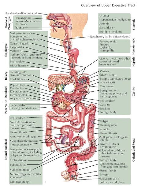 Overview of  Gastrointestinal Bleeding   Bleeding is a common symptom of both benign and malignant disorders of the digestive system. Ble... Intestines Anatomy, Gastrointestinal System, Gastrointestinal Disorders, Nuclear Medicine, Nursing School Studying, Medical School Studying, Medical Anatomy, Medical Coding, Nursing Study