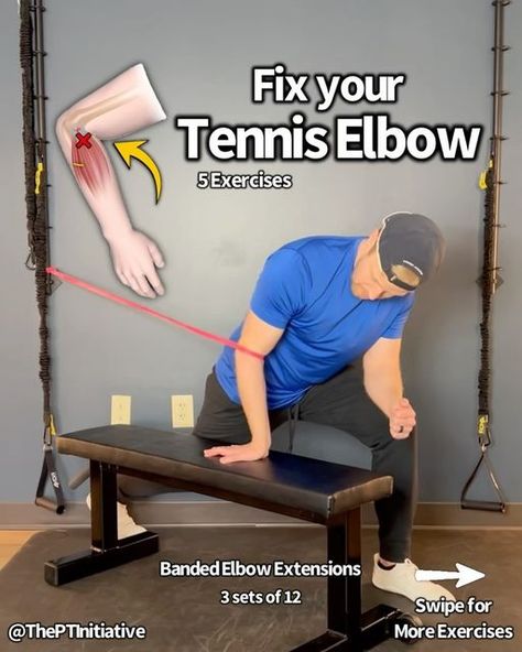 Dr. Adam McCluskey PT, DPT on Instagram: "🙋🏽‍♂️Feeling Stuck with Your Elbow Pain? (Swipe for Exercises + Full Program bundle 50% OFF in @theptinitiative bio link…)
.
🎾Today’s post is for those of you dealing with elbow pain... specifically tennis elbow!
—
👉🏽Lateral epicondylitis (aka tennis elbow) usually presents with dull, aching pain at the outside of the elbow.
😫You may have pain with gripping heavier objects, turning doorknobs, or other forearm dominant movements.
——
💎This pain usually develops when the demand placed through the forearm extensor muscles exceeds what they can handle. This leads to pain at the common extensor tendon.
—-
🔑Initially rest (decreasing volume of strain through the tissue), soft tissue work, and stretching can be helpful... but it’s critical to add i Tennis Elbow Exercises, Elbow Exercises, Bodyweight Back Workout, Glute Medius, Strength And Mobility, Elbow Pain, Gluteus Medius, Abs And Cardio Workout, Tennis Elbow