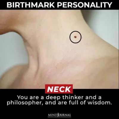 Birthmark Meaning, Mole Meaning, Port Wine Stain, Skin Moles, Healthy Life Hacks, Blood Sugar Diet, Wine Stains, Good Communication Skills, Medical Practice