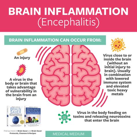 Brain Inflammation (Encephalitis) Brain Inflammation, Severe Fatigue, Brain Stem, Medium Blog, Medical Medium, Cleanse Recipes, Health Articles, Healthy Fitness, Doctor Medical