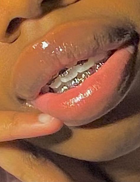 100 % recommend silver as your next braces choice🤍😘 | Cute braces, Braces colors, Brace face Shoe Recommendation, Power Chain Braces, Tongue Web Piercing, Braces Cute, Braces Colors Ideas, Silver Braces, Cute Braces Colors, Braces Cost, Pretty Teeth