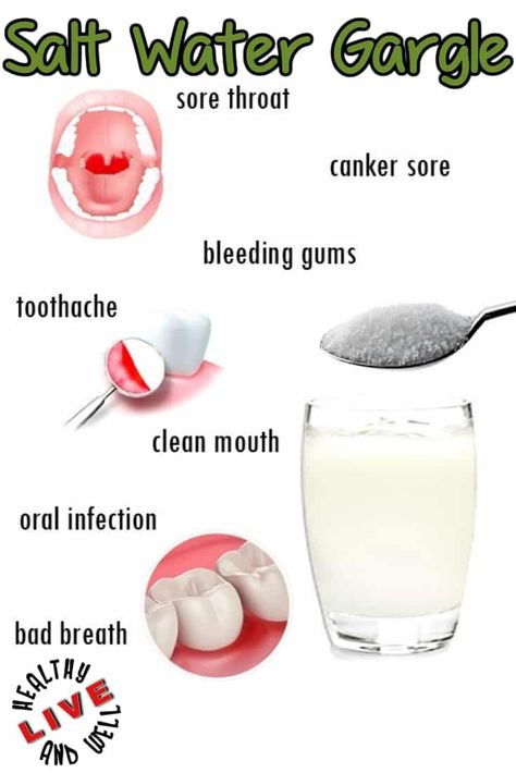 Salt Water Gargle, Oral Health Education, Sensitive Teeth Remedy, Remedies For Tooth Ache, Dental Health Month, Dental Implants Cost, Holistic Health Remedies, Tooth Pain, Teeth Health