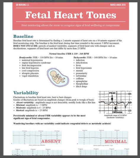 Fetal Monitoring Nursing, Ob Nursing Student Cheat Sheets, Ob Nursing Student, Nicu Nurse Education, Fetal Heart Monitoring, Peds Nursing, Obstetrics Nursing, Obgyn Nurse, Fetal Monitoring