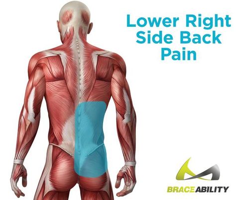 Find out what is causing lower back pain on your right side and in your gluteus Lower Right Back Pain, Lower Back Pain Causes, Mid Back Pain, Severe Back Pain, Causes Of Back Pain, Middle Back Pain, Back Stretches For Pain, Back Pain Remedies, Upper Back Pain