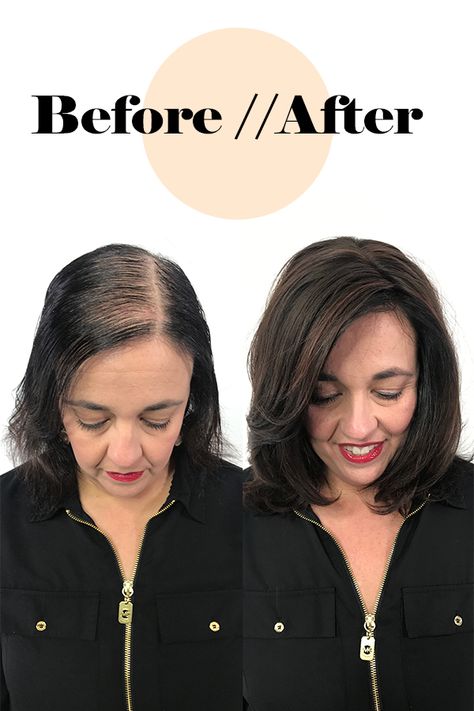 Hairstyle For Thinning Hair On Top Women, Hairstyles For Thinning Hair On Top, Thinning Hair Women, Hair Toppers For Thinning Hair, Special Hairstyles, Thyroid Hair, Fine Hair Tips, Grow Thicker Hair, Balayage Ideas