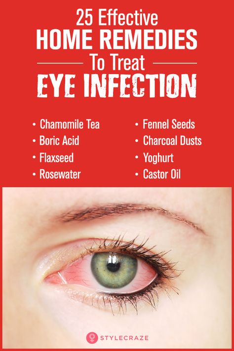 Home Remedies For Eye Infections – Do These 10 Methods Work? Home Remedy For Eye Infection, Irritated Eyes Remedies, Eye Infection Remedies, Eye Irritation Remedies, To Improve Eyesight, Homemade Medicine, Eyes Health, Eyes Care, Lip Care Tips