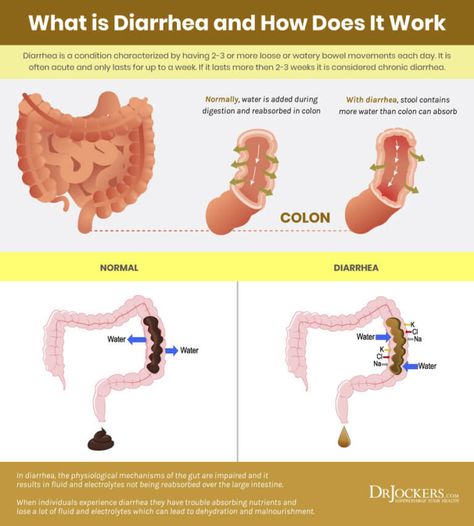 How To Get Rid Of Diaherra, How To Stop Diaherra, Diahrea Remedies, Ileocecal Valve, Pancreatic Diet Recipes, Pancreatic Diet, Abdominal Pain Relief, Indigenous Education, Healing Diet