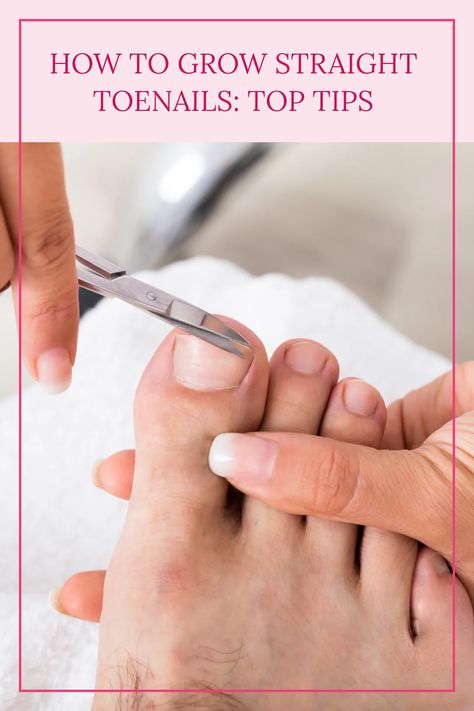 Discover the best ways to promote straight toenail growth and prevent ingrown toenails. Click to learn more! How To Get Healthy Toenails, Toenail Growth Fast, Diy Ingrown Toenail Remedy, How To Whiten Toenails, Toe Nail Growth Remedies, Ingrown Toenail Remedy, Ingrown Toenail Remedies, Healthy Toenails, Nail Growth Faster