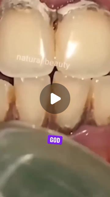 Lose Weight on Instagram: "Remove Tartar and Yellowness From Your Teeth  Follow @womanbodytip  #teethwhitening #yellowteeth #remedy #naturalremedies" Remove Tartar From Teeth At Home, Tumeric Teeth Whitening, Tartar Teeth, Natural Teeth Whitening Diy, Teeth Covers, Tartar Removal, Teeth Whitening Diy, Yellow Teeth, Privacy Fence Designs