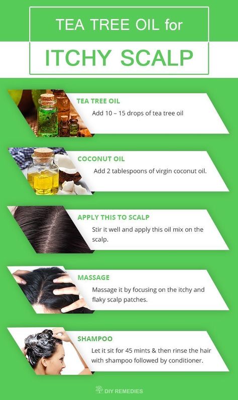 Best Tea Tree Oil, Shampoo Diy, Flaky Scalp, Benefits Of Coconut, Benefits Of Coconut Oil, Itchy Scalp, Hair Treatments, Hair Remedies, Dry Scalp