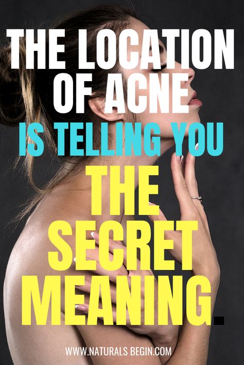 The Location of Acne is telling you the secret meaning. - Naturals Begin Acne On Forehead Reasons For, Acne On Forehead, Forehead Breakout, Closed Comedones, Neck Acne, Skin Blackheads, Blind Pimple, Forehead Acne, Pimples Under The Skin