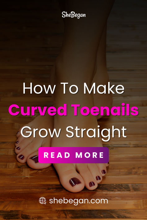 Having a curved toenail can create a sense of urgency to straighten it up as this could be an early sign of nail impairment. This pin explores how you can make curved toenails straight when you notice this abnormality. Curled Toenails, Curved Toenails, Hammer Toe Correction, Nail Remedies, Sense Of Urgency, Toe Straightener, Nail Infection, C Curl, Ingrown Toe Nail