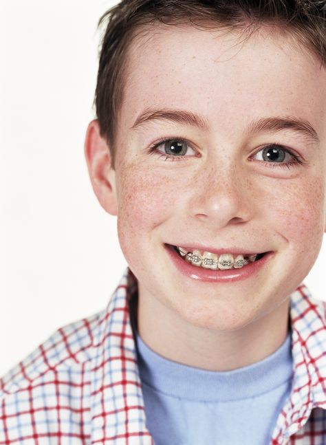 Orthodontics in Fort Worth Kids Braces, Braces Girls, Blonde Hair Boy, Kids Dentist, Pediatric Dental, Dental Braces, Straight Teeth, Teen Boy Outfits, Pediatric Dentistry