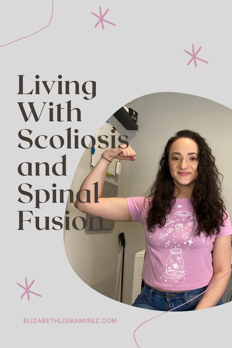 Spinal Fusion Surgery Recovery, Life Tricks, Spinal Fusion Surgery, Posture Brace, Spinal Fusion, Spinal Surgery, Full Body Stretch, 19 Years Old, Gainesville Florida