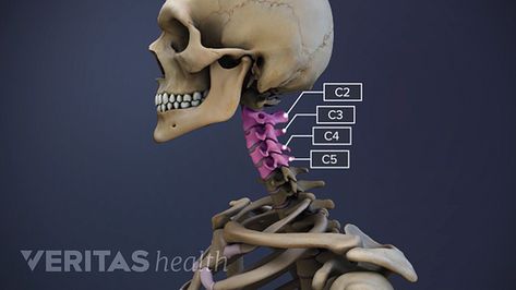 Whiplash Injury, Cervical Disc, Disc Herniation, Cervical Spondylosis, Disk Herniation, Cervical Vertebrae, Spinal Nerve, Bladder Control, Spine Health