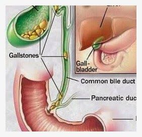 Gallbladder Attack, Gallbladder Cleanse, Gallbladder Surgery, Pet Ct, Nuclear Medicine, Bile Duct, Human Body Anatomy, Medical Anatomy, Body Anatomy