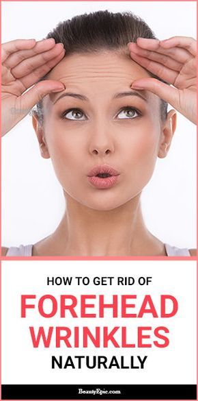 how to get rid of forehead wrinkles naturally Prevent Forehead Wrinkles, Get Rid Of Forehead Wrinkles, Reduce Forehead Wrinkles, Wrinkle Remedies, Natural Anti Aging Skin Care, Wrinkle Free Skin, Forehead Wrinkles, Eye Wrinkle, Unwanted Hair Removal