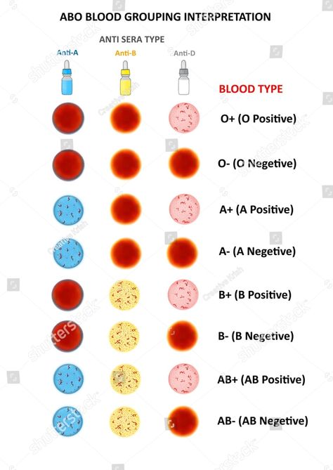 Laboratory Tests Medical, Physiology Wallpaper, Medtech Student, Way To Draw People, Medical Laboratory Science Student, Learn Biology, Medical Laboratory Technician, Med Lab, Remove Wallpaper