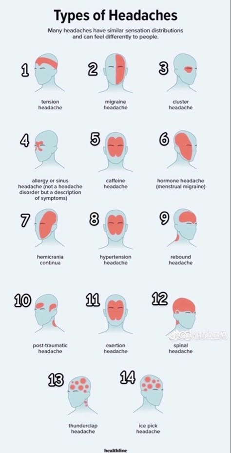 Pressure Point Therapy, Homeopathy Remedies, Health Chart, Medical School Life, Basic Anatomy And Physiology, Headache Types, Nurse Study Notes, Too Much Estrogen, Nursing Student Tips